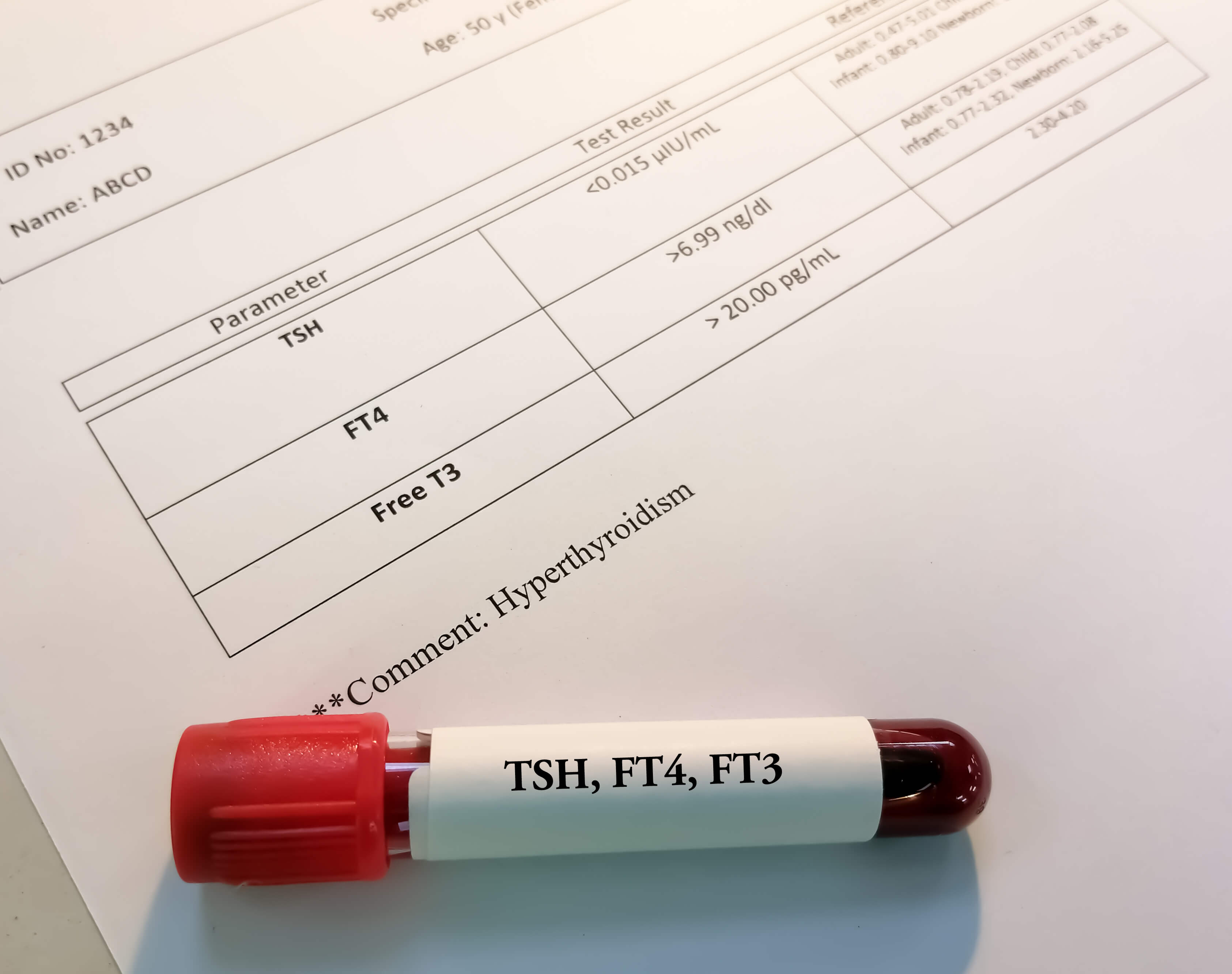 hypotyreoza krevni test hodnoty